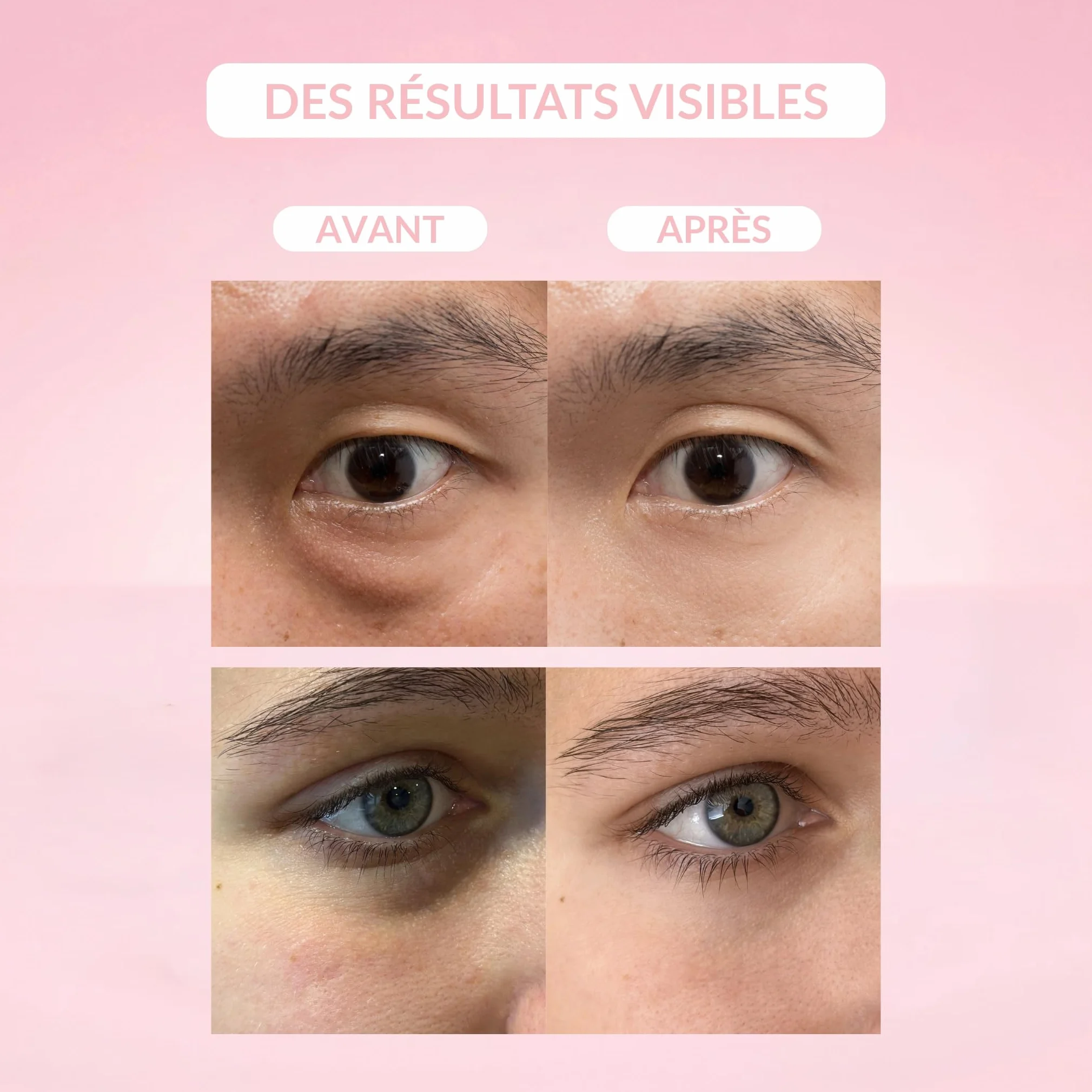 Patchs Anti-Cernes à la Caféine 30 Paires (60 Patchs) Décongestionne le contour des yeux Réduit les poches cernes et signes de fatigue Effet Booster Regard 98% d’Origine Naturelle 100/100 Yuka