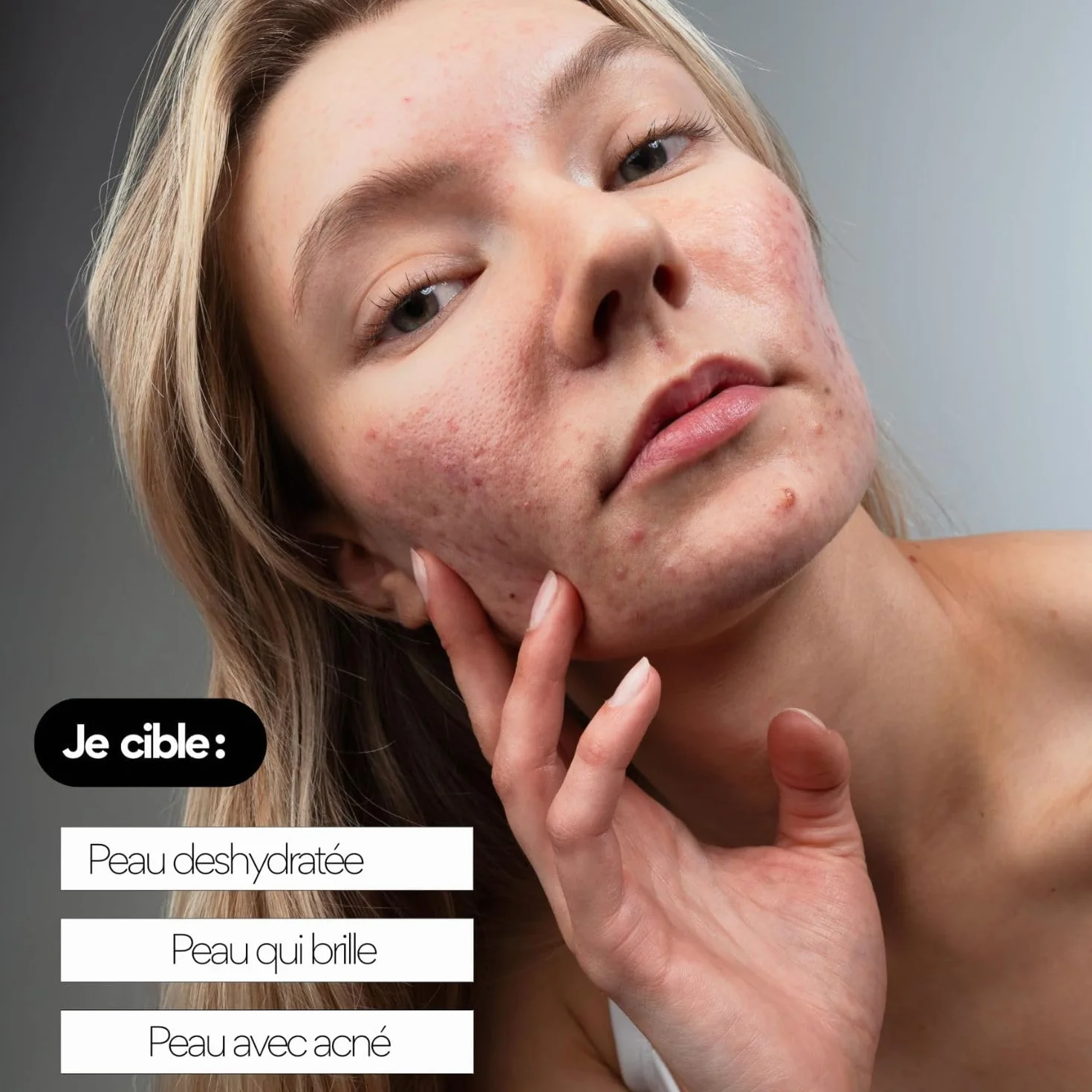 Crème Hydratante Peaux Mixtes à Grasses 99% d’Origine Naturelle Hydrate Apaise les boutons Régule le Sébum Fini non gras