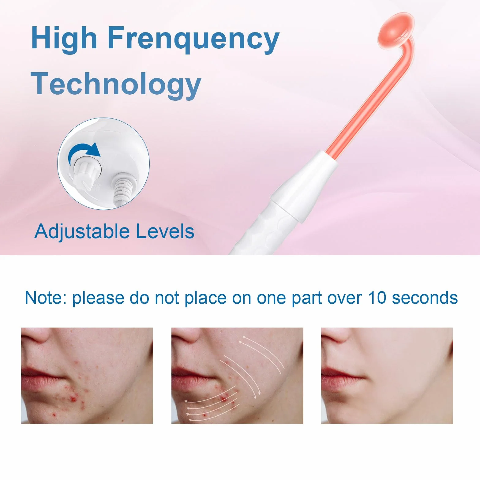Yofuly Appareil Haute Fréquence avec 4 Rouge Neon, Haute Fréquence Portable Outils de Beauté Faciale Visage Baguette pour Réduire Les Rides, Les Yeux Gonflés, Les Cernes, La Perte de Cheveux
