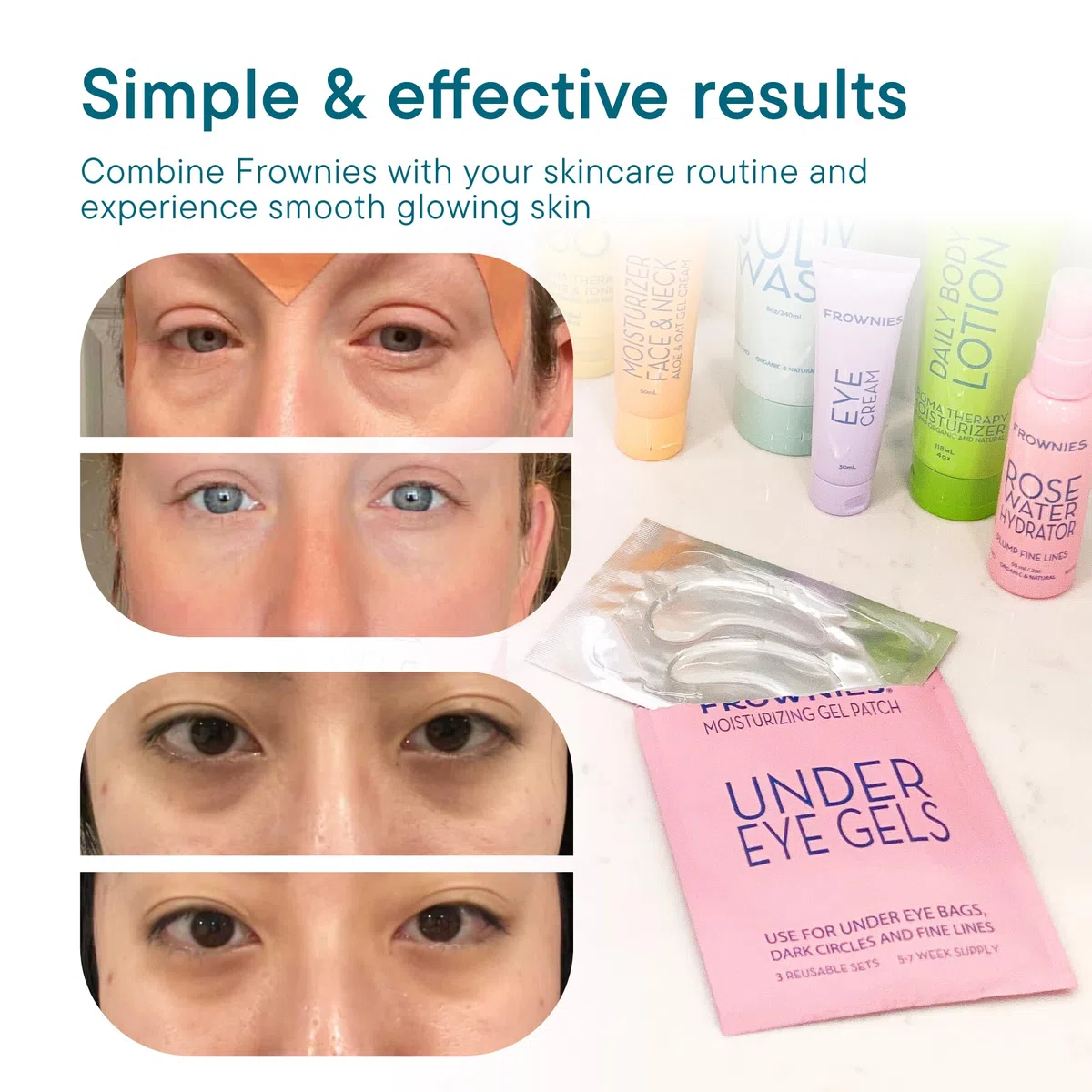 Frownies, gels pour les yeux sous l'œil et la paupière traitement, 3 Sets réutilisables