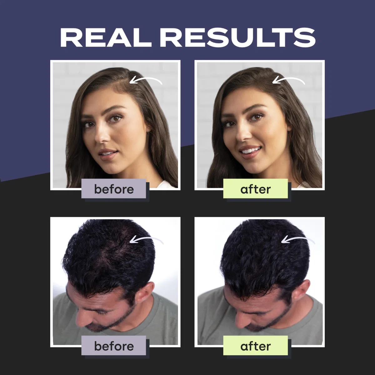 TOPPIK Fibres Capillaires Densifiantes à base de Kératine, Noir - 55g - Cheveux à l'Aspect Naturellement plus Epais – Pour densifier Racines, Ligne Frontale, Barbe, Calvitie