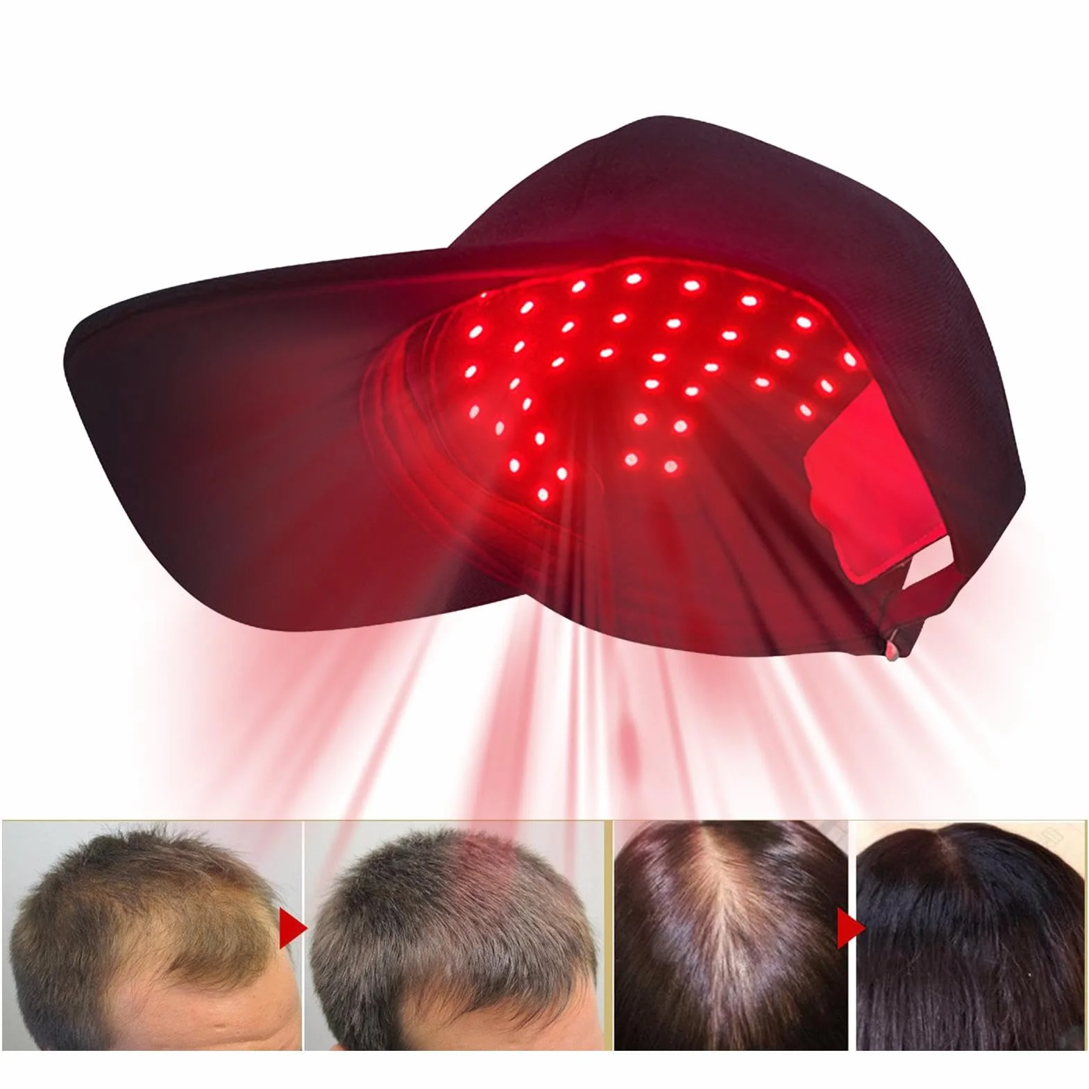 Bonnet de croissance des cheveux, LED pour la croissance des cheveux, infrarouge pour améliorer la circulation du cuir chevelu, rechargeable et sans fil, noir, 450 nm/660 nm/850 nm, pour homme et