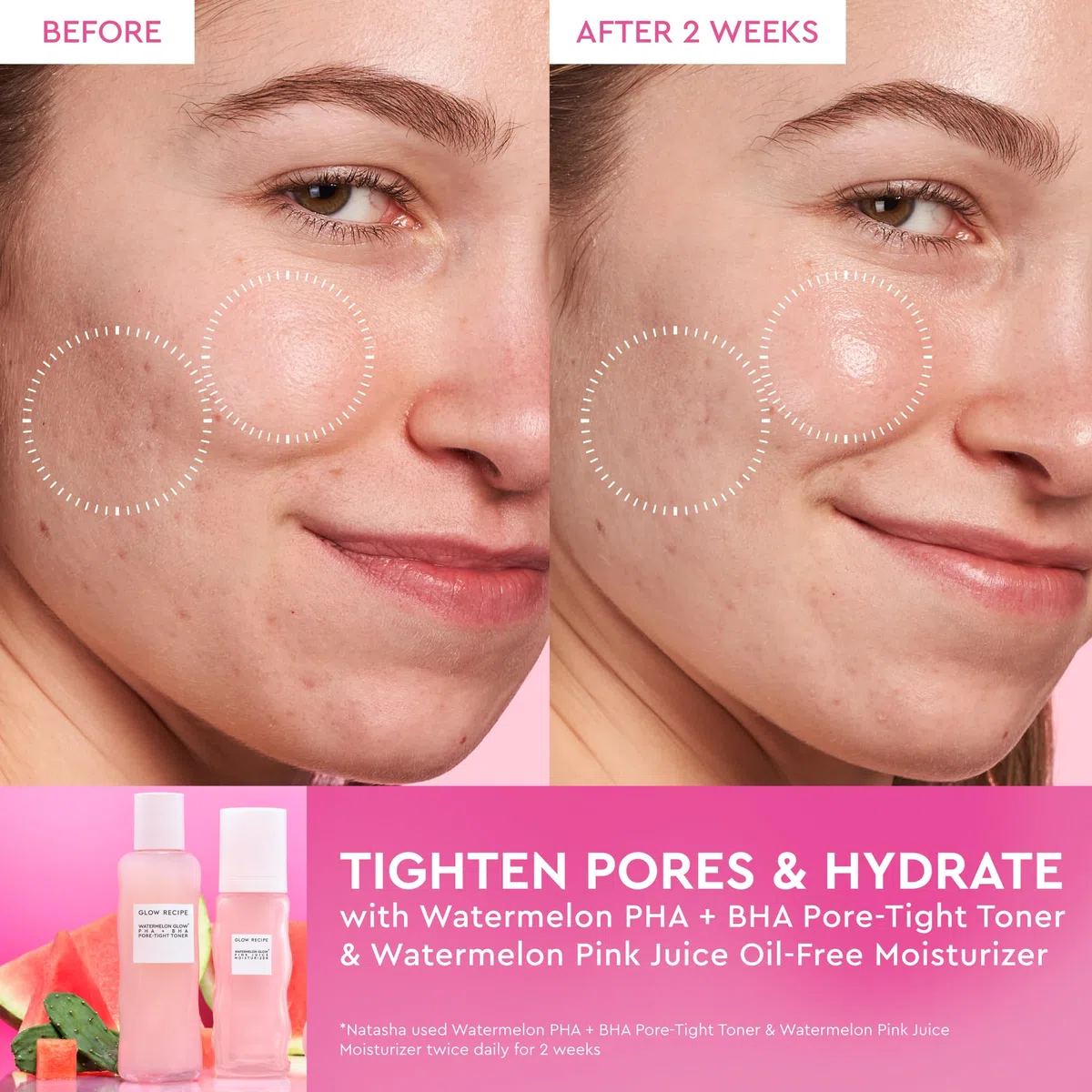 Glow Recipe Watermelon Glow PHA + BHA Pore-Tight Toner 150ml