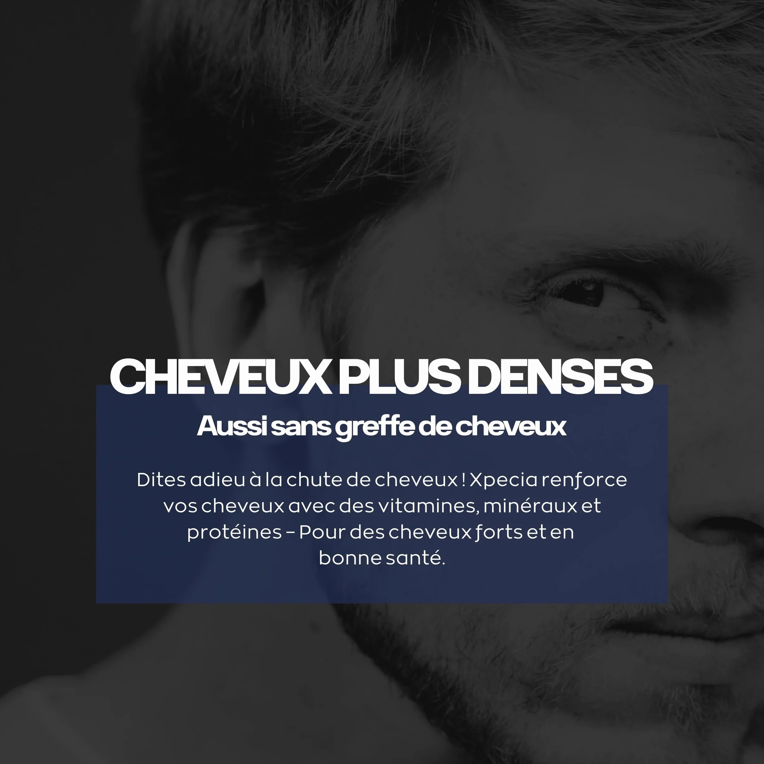 XPECIA Comprimés contre la chute des cheveux, bloque DHT, croissance cheveux 120 Unité (Lot de 2 boites de 60)