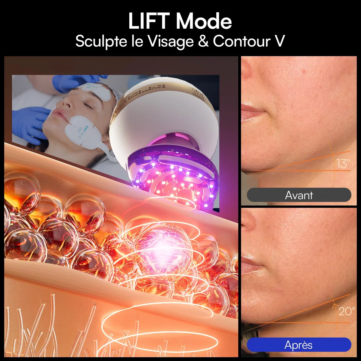 INIA SPHERA Appareil Facial Microcourant 8-en-1 Amélioré pour Visage et Cou – Lumière Rouge, Chauffant & Refroidissant, 5 Modes Personnalisés, Soin de la Peau et Éclat à Domicile