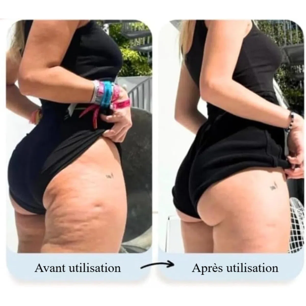 Vacuvia SculptGlow, Appareil anti-cellulite 4-en-1, massage par vide et chaleur, corps (Vacuvia Pro)