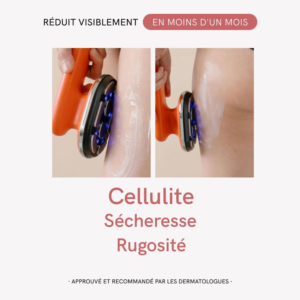 MASDERM - Cellulite 2-en-1, Appareil Radiofréquence Corporelle Professionnel avec Crème Anti-Cellulite Raffermissante 500 ml et Technologie EMS LED, Traitement Réducteur et Anti-Graisse - Pack de 2