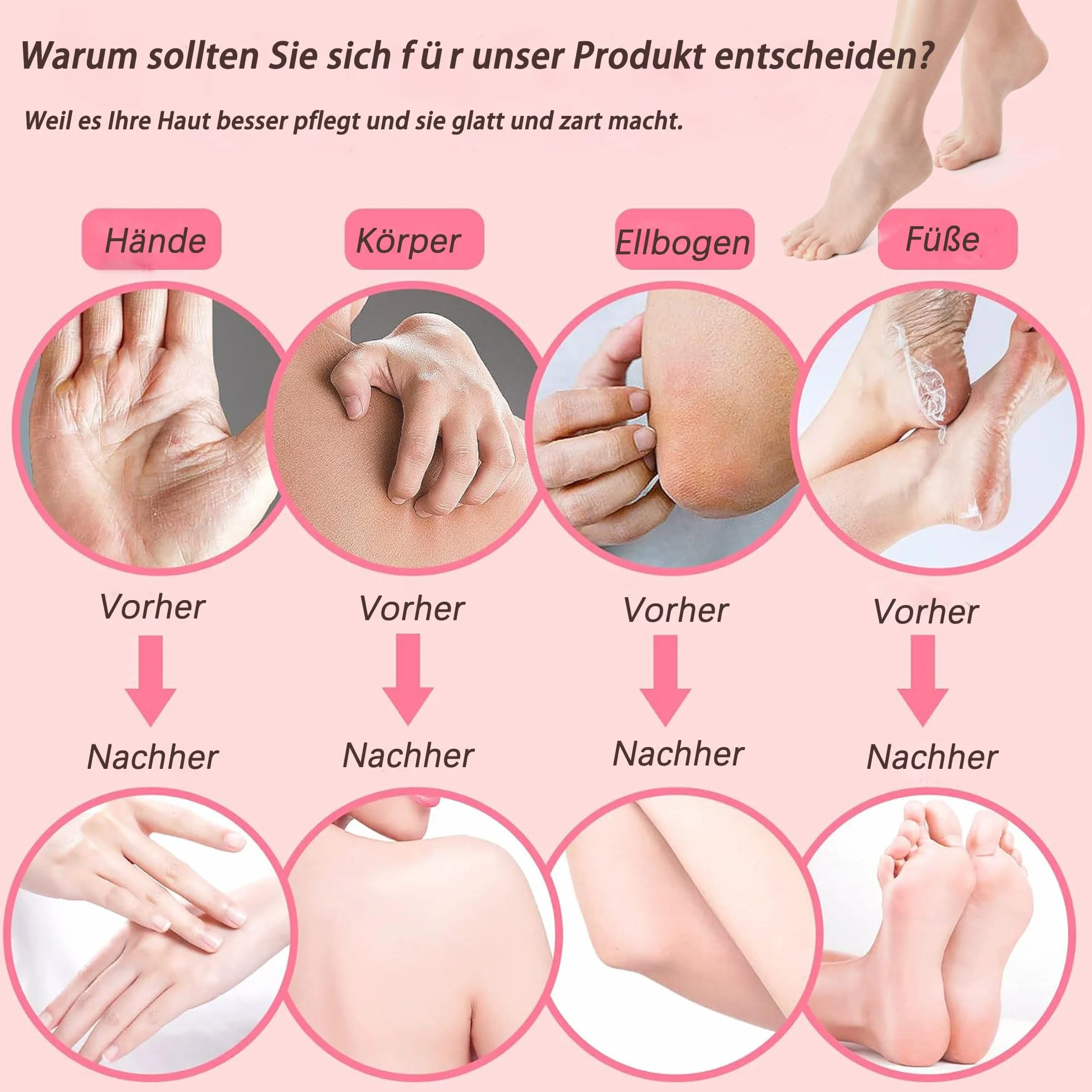 Bain de paraffine 4000ml pour mains et pieds, cire de paraffine 900g avec accessoires, soin peaux sèches (rose)
