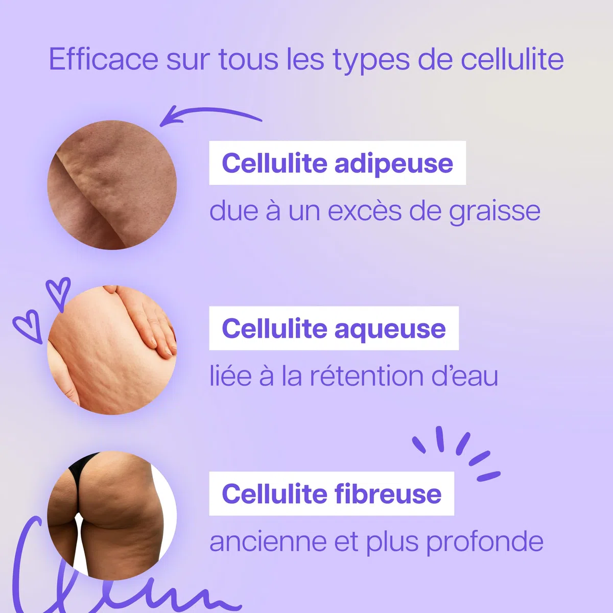 Ventouse Anti-Cellulite Électrique - Palper-rouler Automatique & Aspiration Puissante - Réduit la Peau d’Orange Rapidement - Cible Tous Types de Cellulite - Ventre, Cuisses, Bras, Jambes