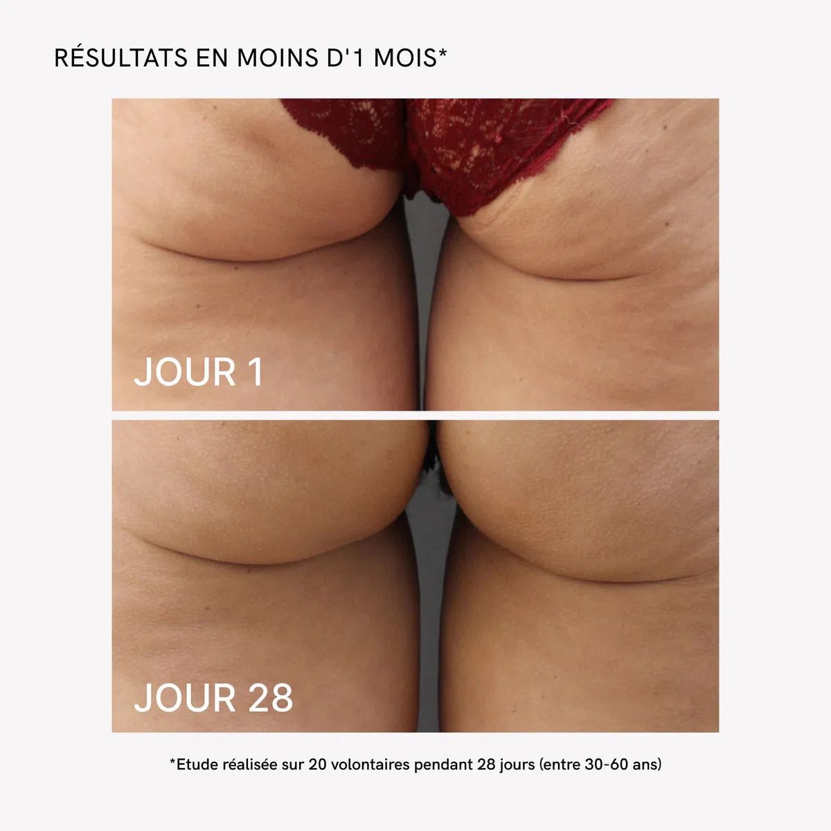 MASDERM - Cellulite 2-en-1, Appareil Radiofréquence Corporelle Professionnel avec Crème Anti-Cellulite Raffermissante 500 ml et Technologie EMS LED, Traitement Réducteur et Anti-Graisse - Pack de 2
