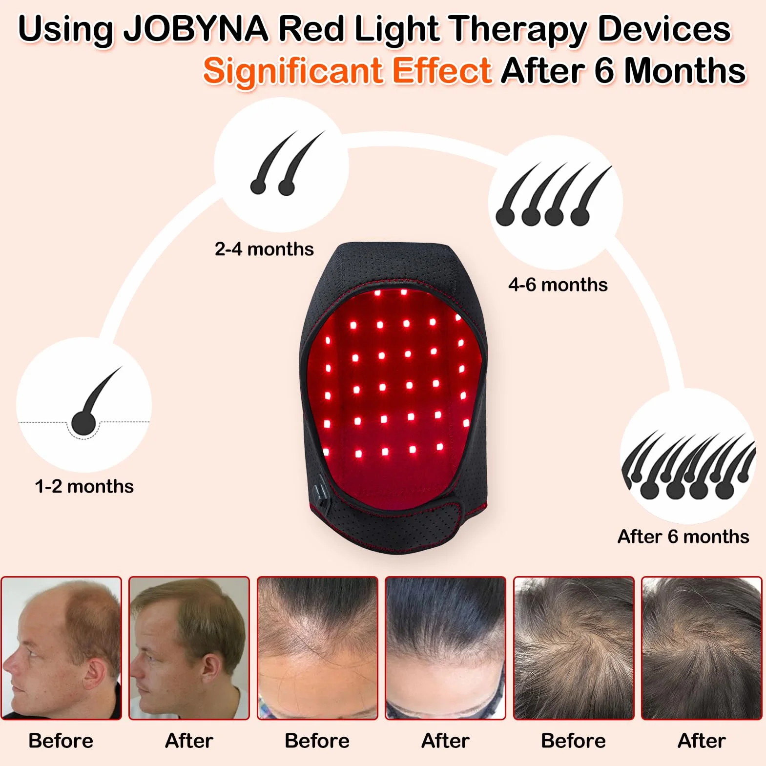 JOBYNA Thérapie par la Lumière Rouge et Infrarouge et Bleue pour la Repousse des Cheveux, Chapeau de Luminothérapie Lampe Infrarouge, Red Light Therapy pour la Perte de Cheveux, Douleur