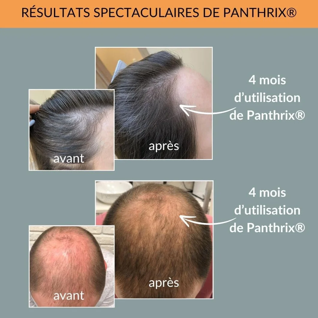 Panthrix Sérum Croissance Cheveux Redensyl 3% Anti Chute Repousse Caféine Kératine Niacinamide 100 ml