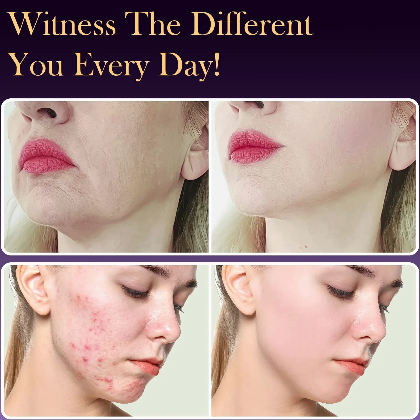 TUMAKOU Appareil Haute Frequence Esthetique Argon 6 en 1 - Appareil Haute Fréquence Visage pour l'acné, les Rides, le Raffermissement de la Peau- Soins pour le Visage