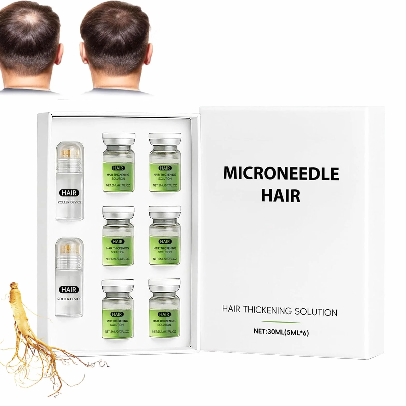 Alphainfuse Système de repousse des cheveux, sérum micro-aiguilles croissance cheveux, traitement renforce racines (1PC)