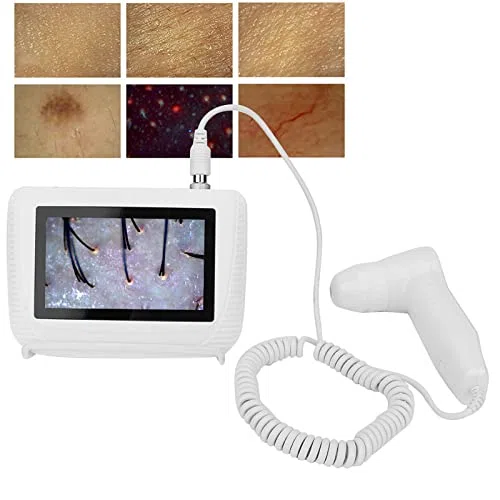 Analyseur de Cheveux de Diagnostic de Peau,50X 200X,Analyseur de Détecteur Grossissant d'humidité D'huile de Follicule Pileux de Cuir Chevelu Rechargeable,Pigments Cutanés