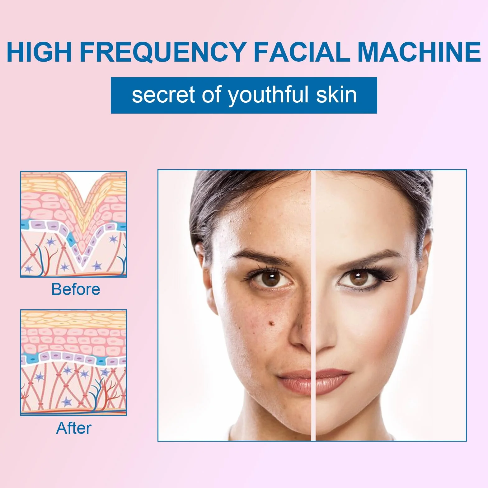 Yofuly Appareil Haute Fréquence avec 4 Rouge Neon, Haute Fréquence Portable Outils de Beauté Faciale Visage Baguette pour Réduire Les Rides, Les Yeux Gonflés, Les Cernes, La Perte de Cheveux